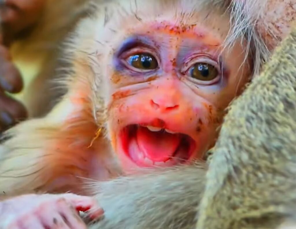 Baby monkey resting carefully after a dangerous fall, showing swollen darkened eyes while receiving gentle care and comfort.